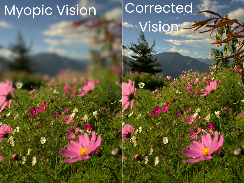 Myopia – Nearsightedness : Conquer the New Pandemic: Tips to Protect Your Vision